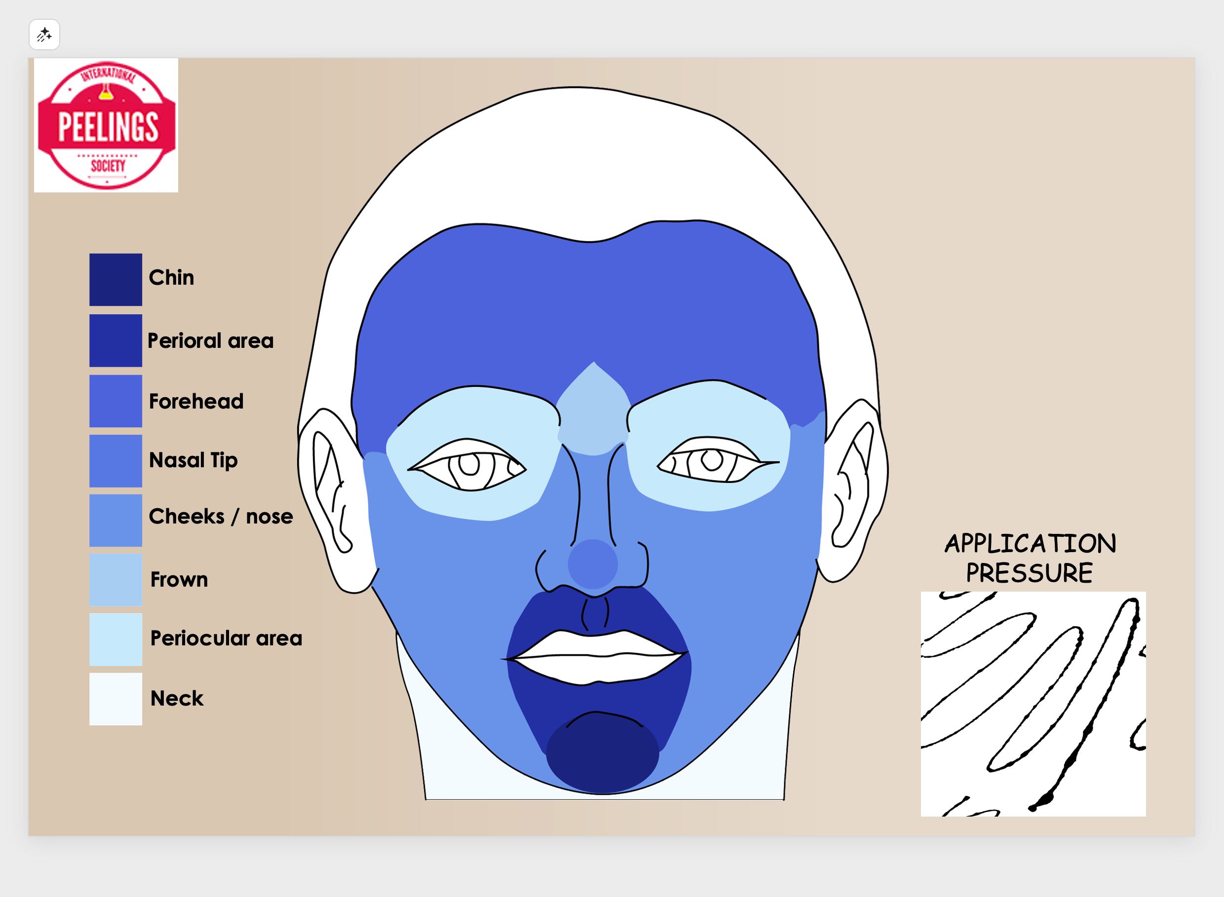 Chemical peel application zones and pressure-dependent depth variation across facial areas