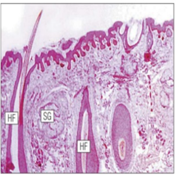 Histological appearance of external labia majora skin showing cutaneous structures and hair follicles