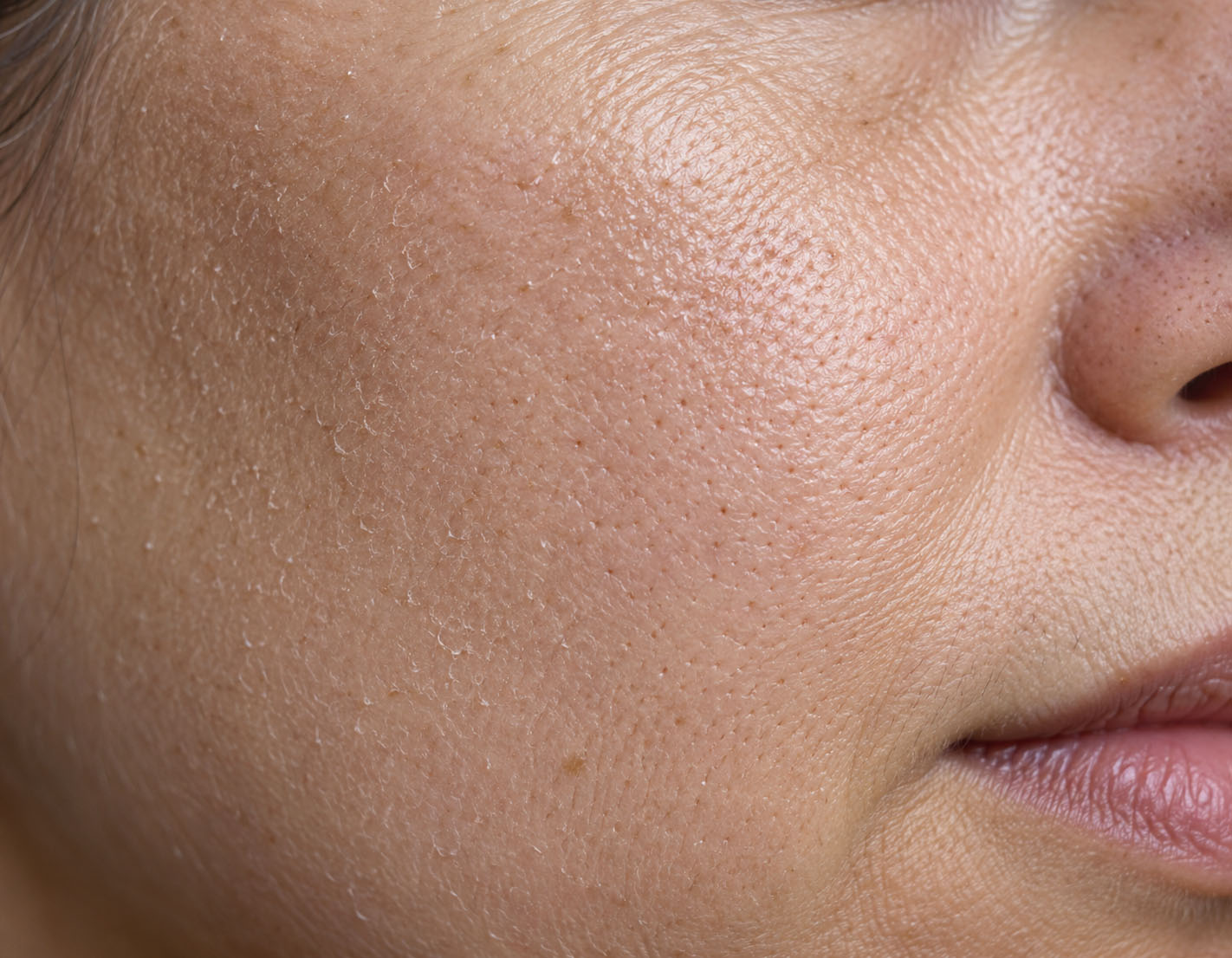 Clinical educational visualization of dehydrated facial skin with uneven surface reflection
