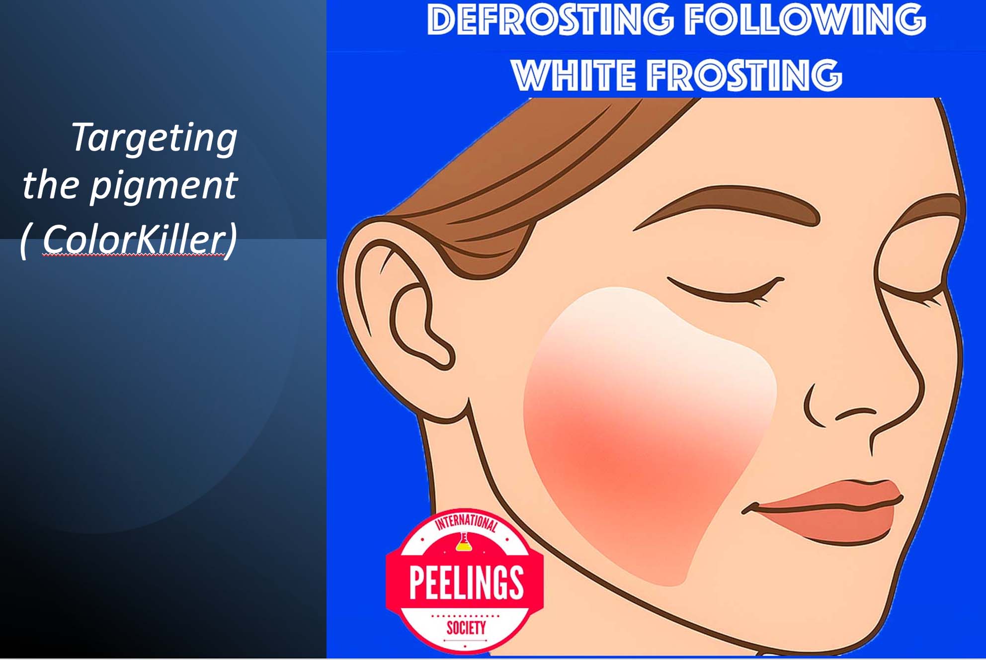 defrosting following the white frosting