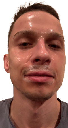 frontal view 45 min after 1 st application insufficient