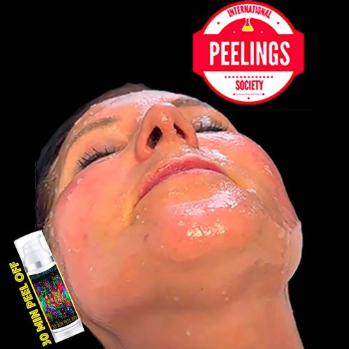 skin aspect at the end of application of 30 min peel off before removal