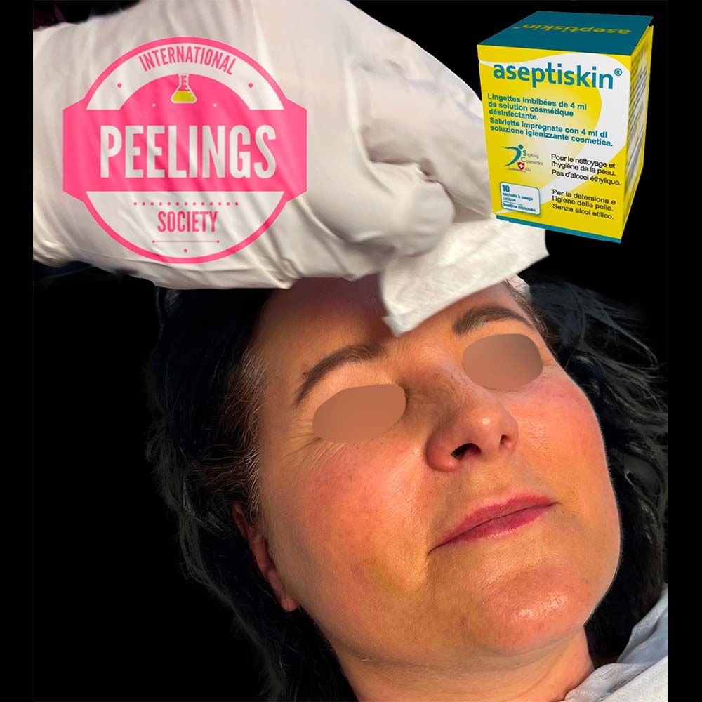 make up removal with aseptiskin