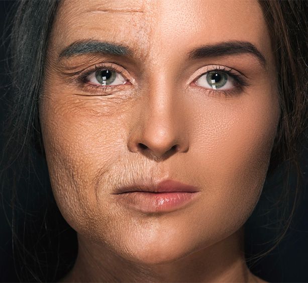 face wrinkles before and after