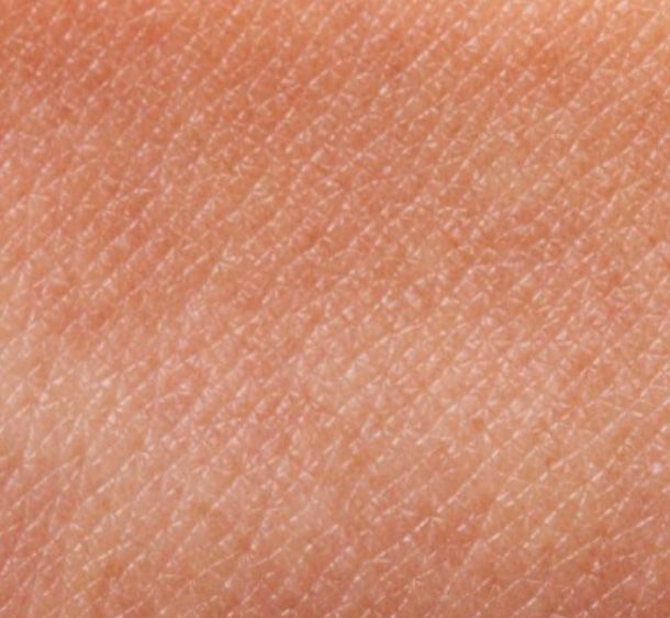 uneven skintone